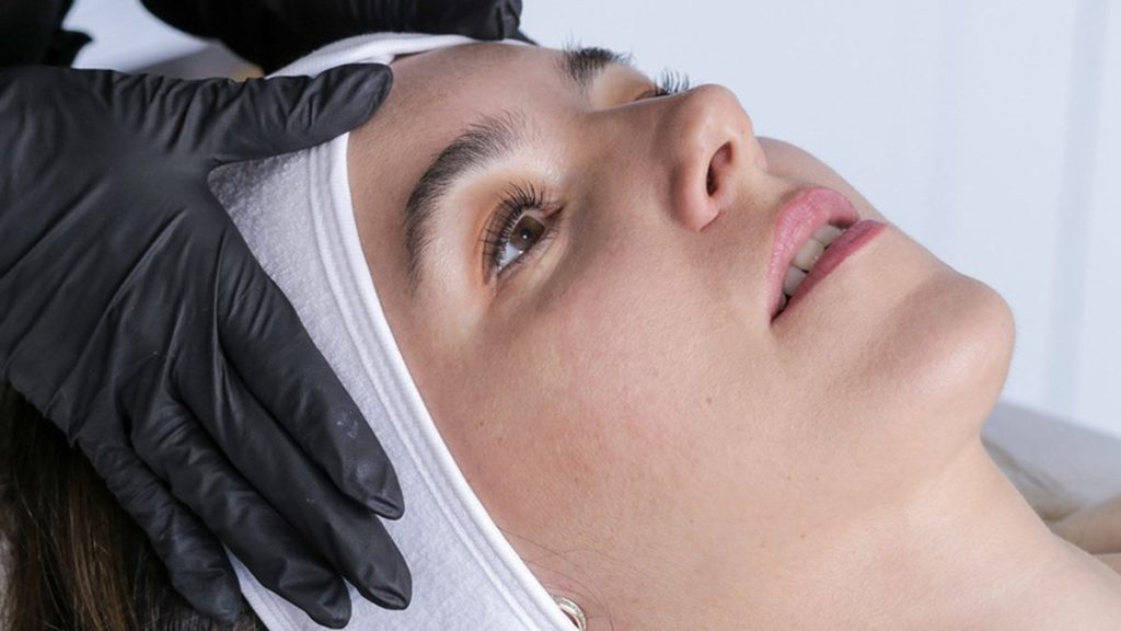 Client prepared for a medical-grade chemical peel in Maple, Vaughan