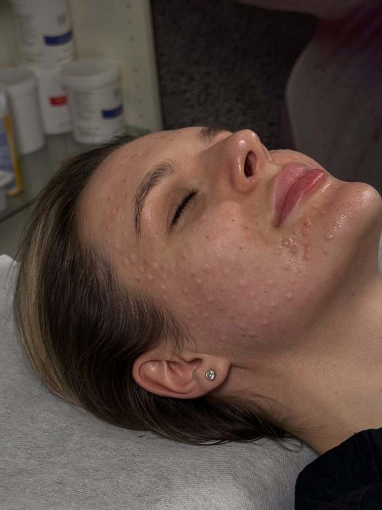 Client resting after a skin treatment at Beauty Maison Aesthetics