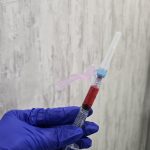 Blood drawn for platelet-rich plasma preparation