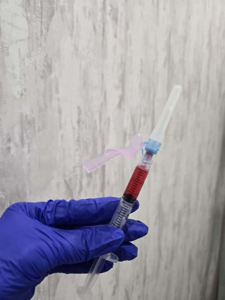 Blood drawn for platelet-rich plasma preparation