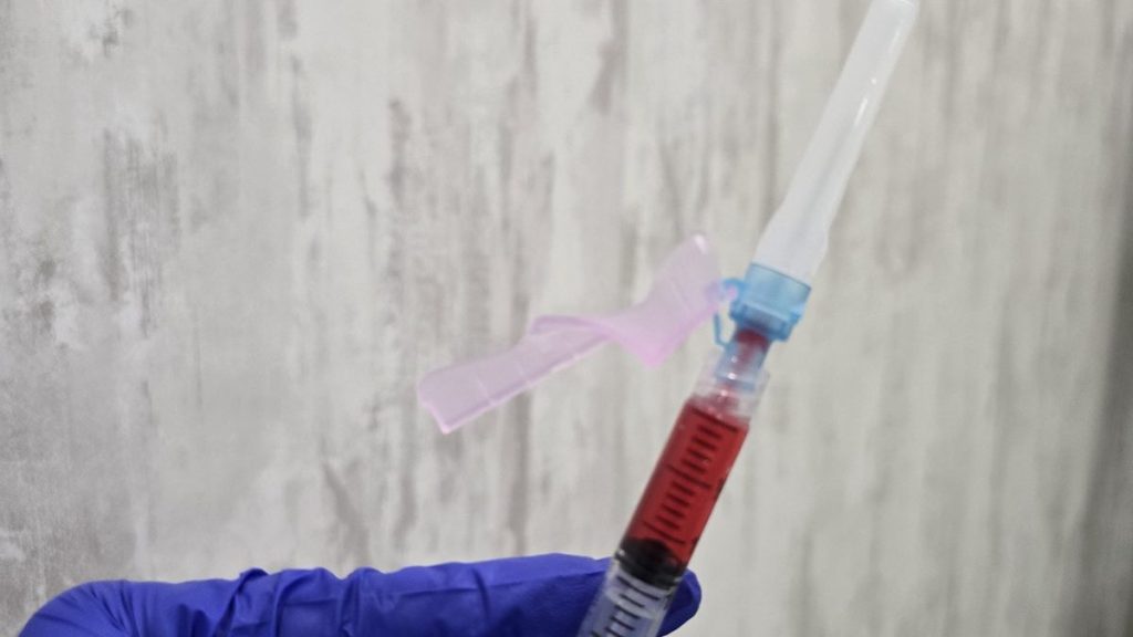 Blood drawn for platelet-rich plasma (PRP) treatment in Maple, Vaughan