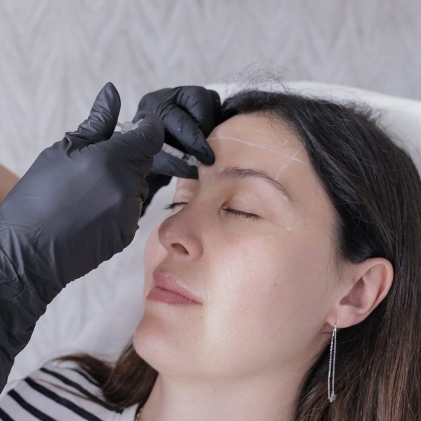 Forehead wrinkle relaxer treatment at Beauty Maison Aesthetics in Maple, Vaughan